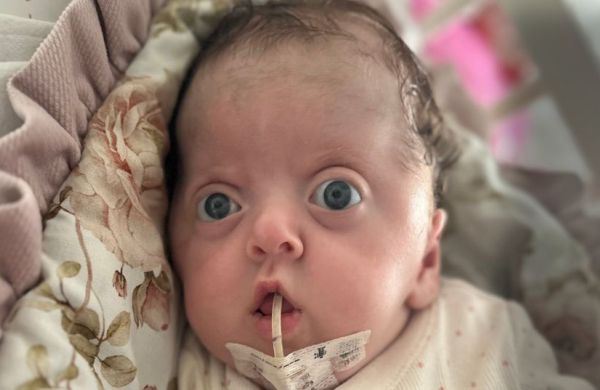 Okrutna diagnoza tuż po narodzinach. Pomóż Iguni!