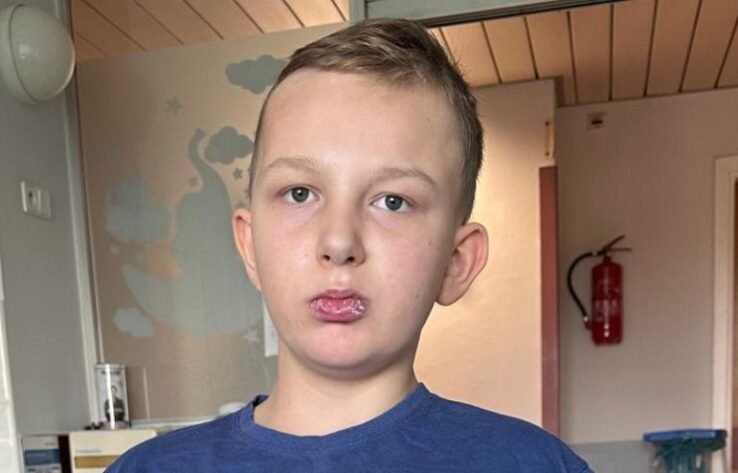 Życie Oliwiera to cud. Sprawmy aby mógł chodzić!